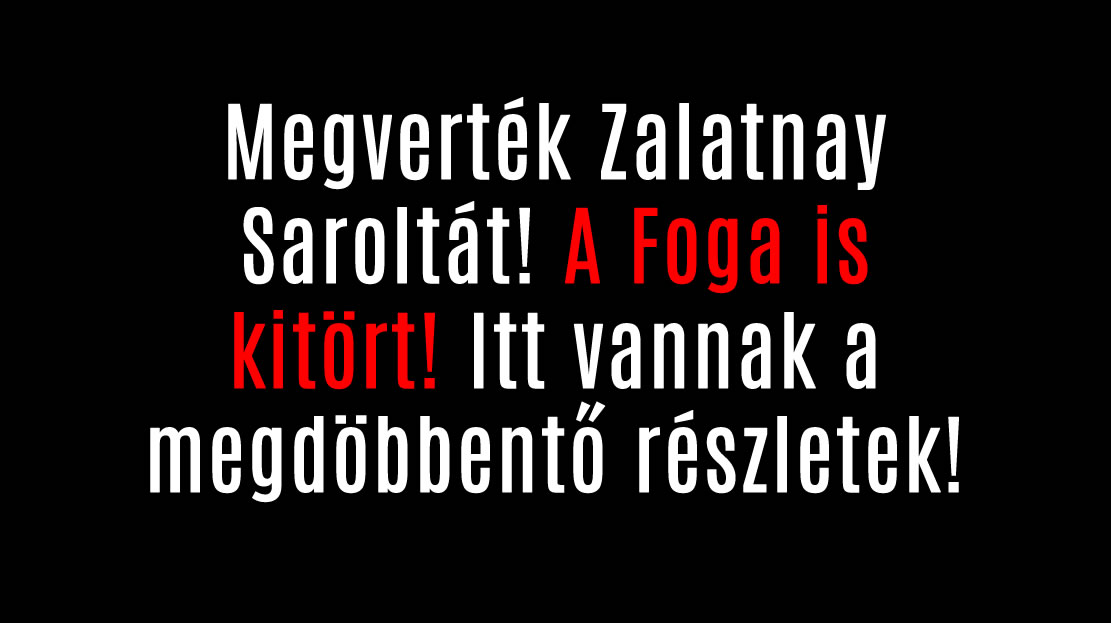 Megverték Zalatnay Saroltát! A Foga is kitört! Itt vannak a megdöbbentő részletek!